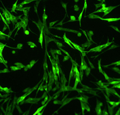 細(xì)胞轉(zhuǎn)染