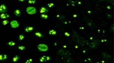 Cy5.5標(biāo)記人轉(zhuǎn)鐵蛋白(TF-Cy5.5)